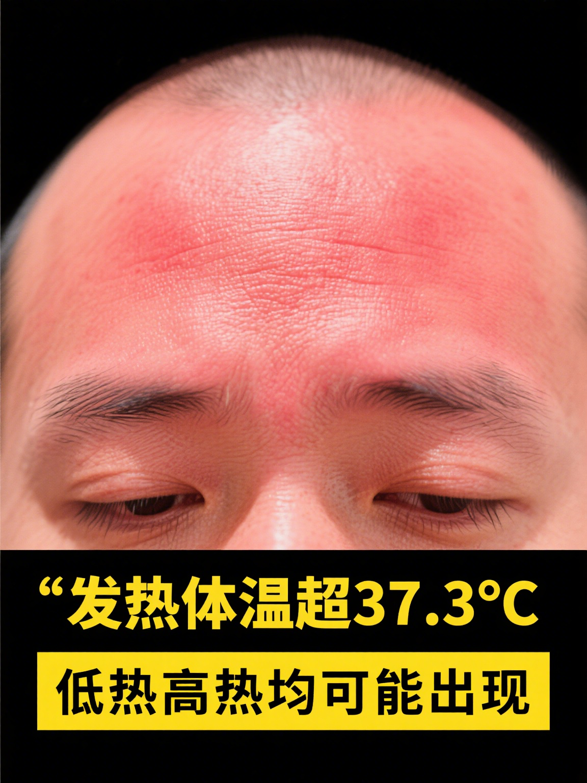  新冠疫情会全身酸痛嘛(新型冠状病毒会导致全身酸痛吗)