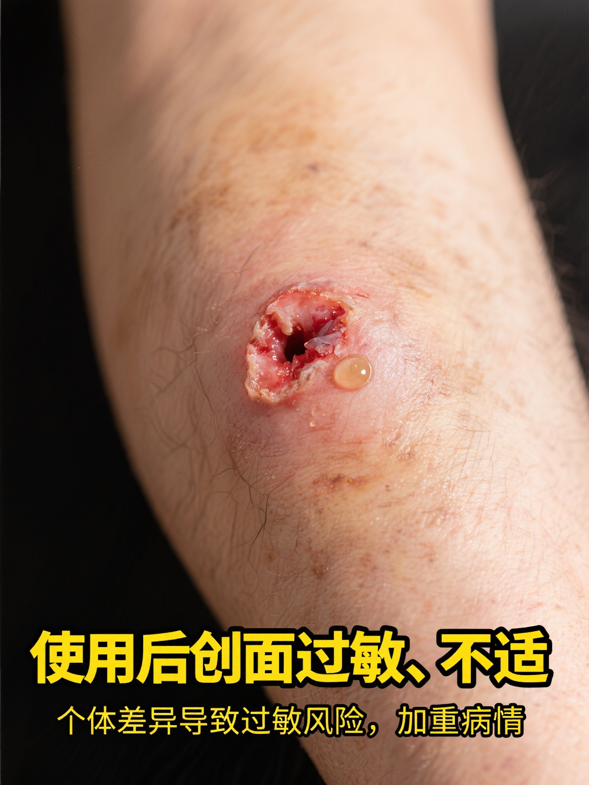 为什么医生一般不开康复新液 康复新液,听名字就知道它在康复治疗方面