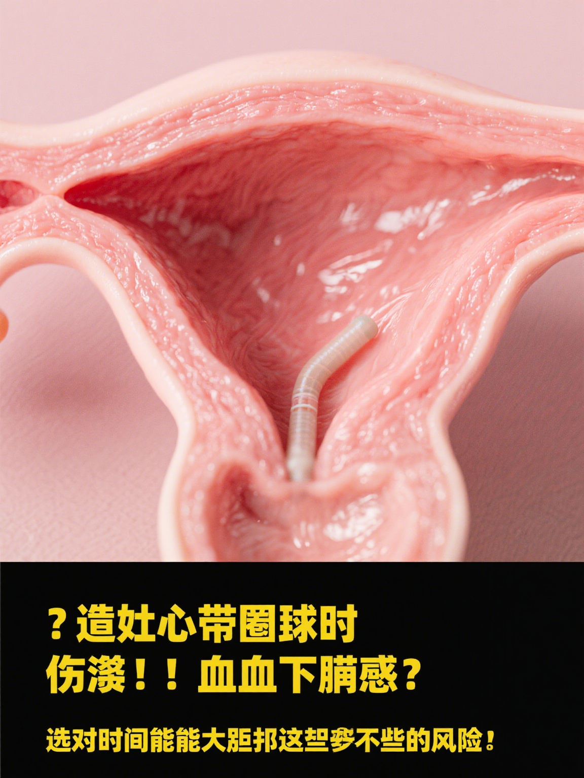带节育环的最佳时间 节育环作为一种长效,可逆的避孕方式,深受很多