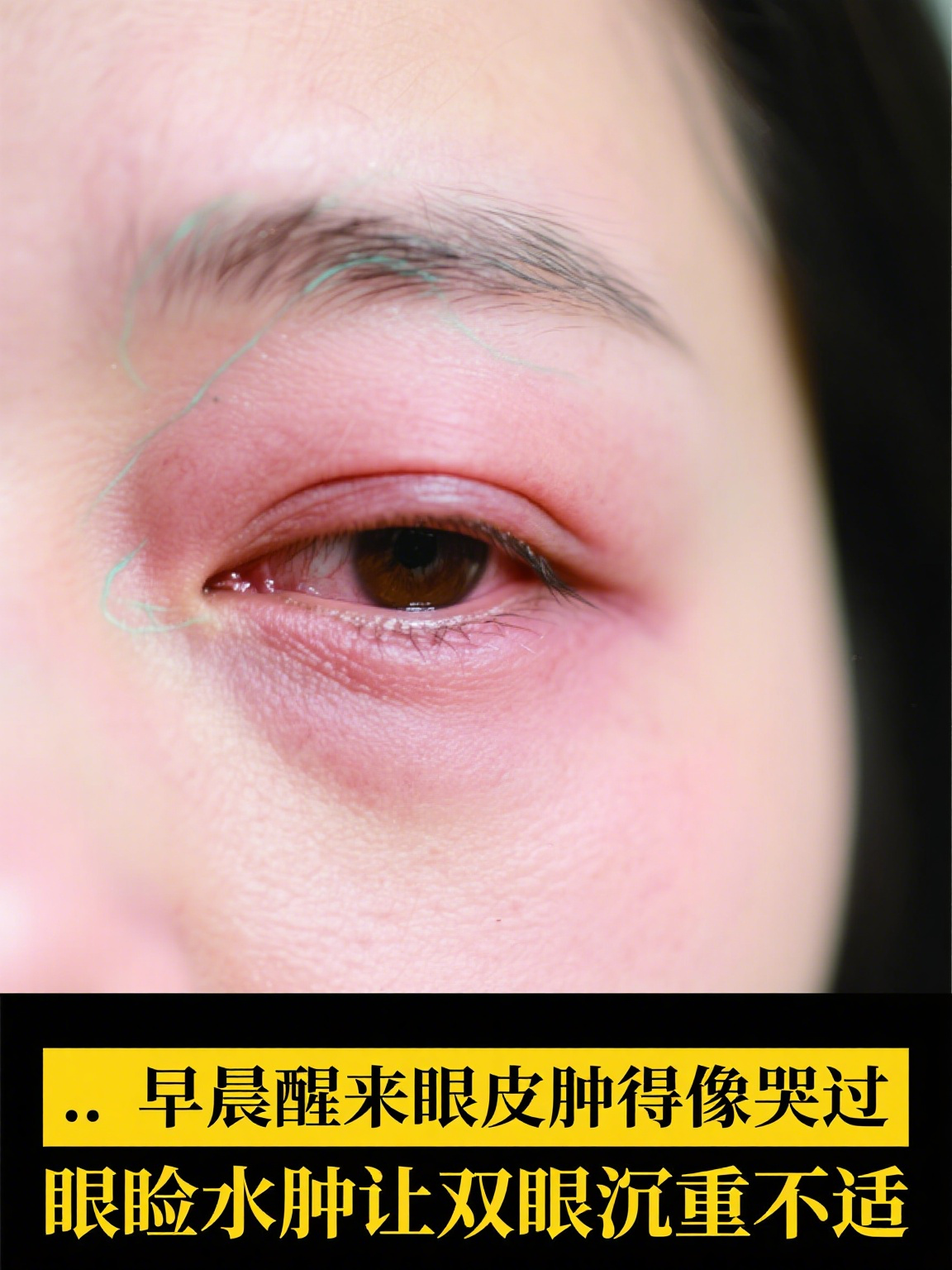 睡觉哭醒是什么原因百科在线