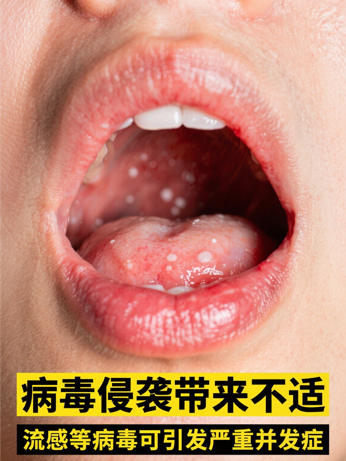  这次病毒严重吗?(病毒又严重了吗)
