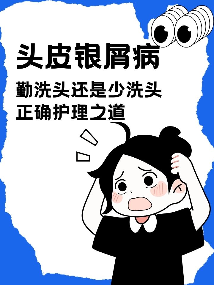 银屑病护理