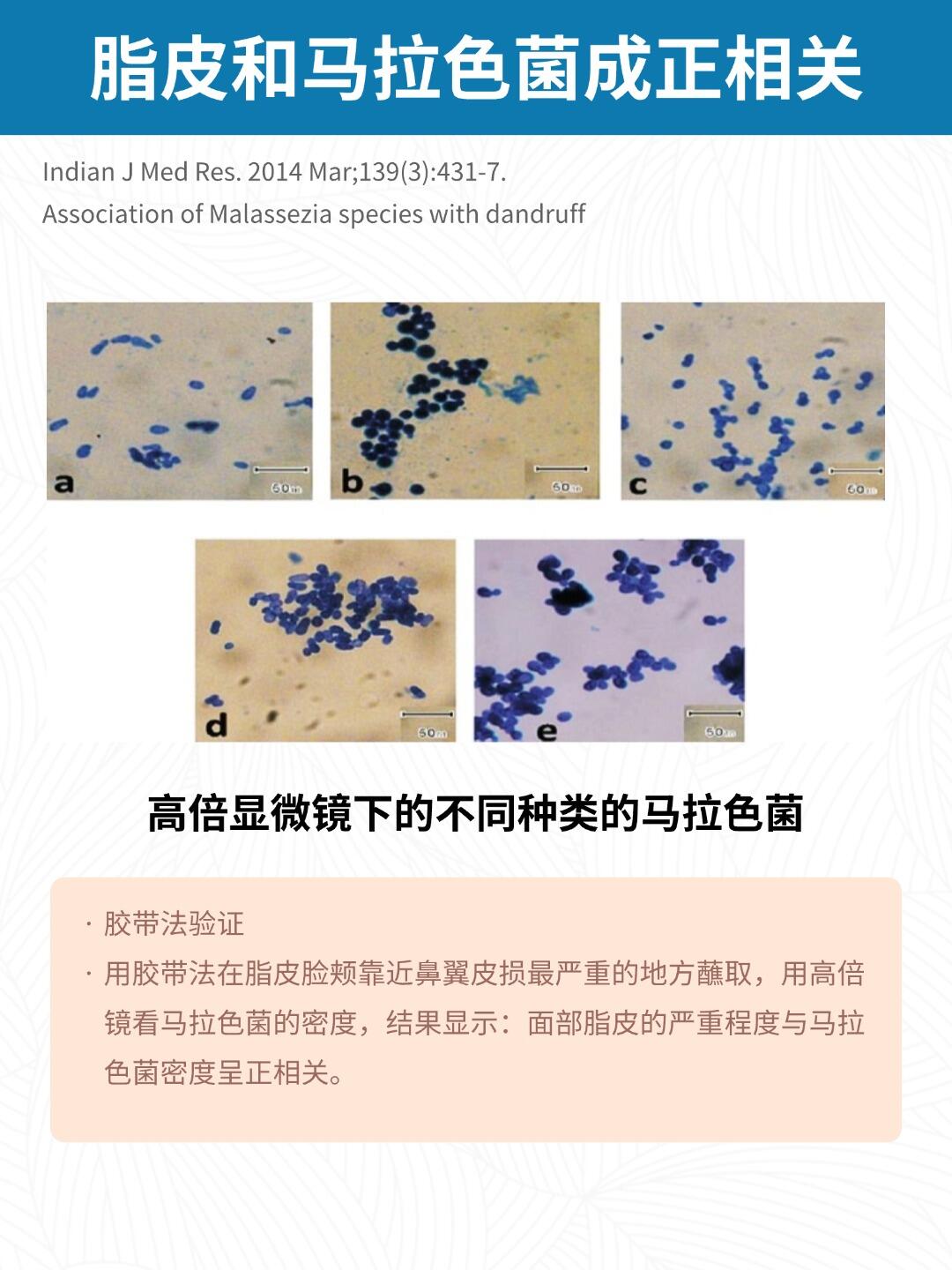 而造成脂皮的因素有很多像马拉色菌皮脂腺分泌增多表皮屏障破坏