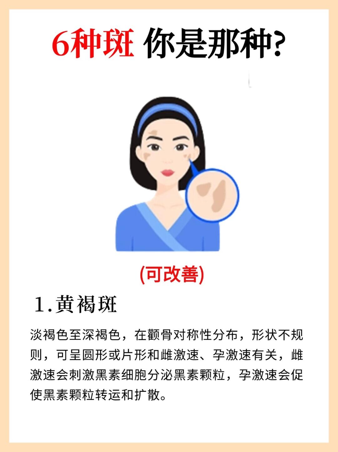 黄褐斑