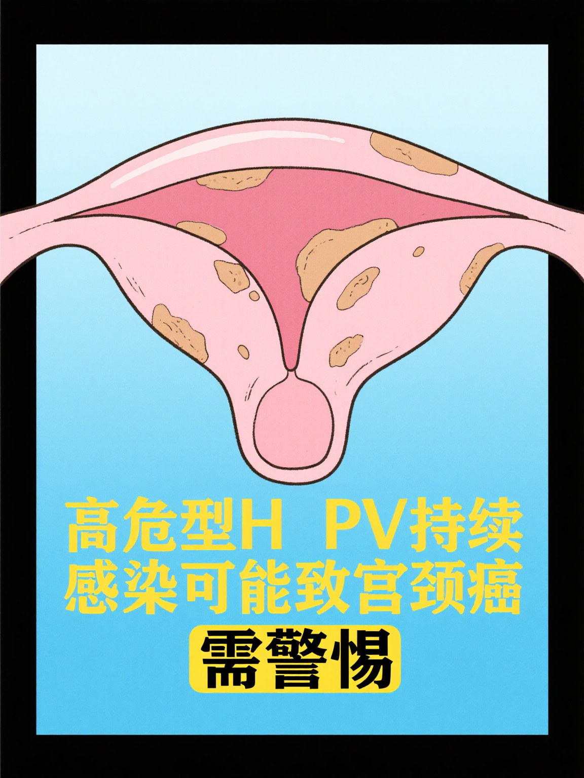  现在是一种什么病毒了(现在这个病毒是什么病毒)