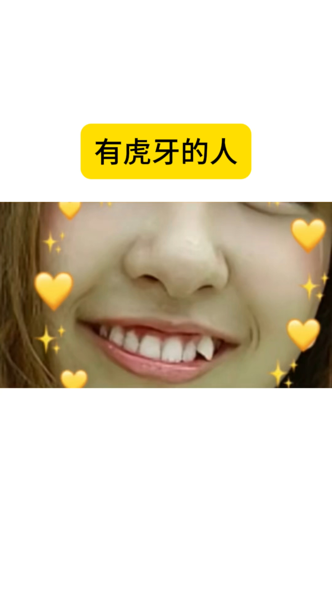 有虎牙的人有什么特点