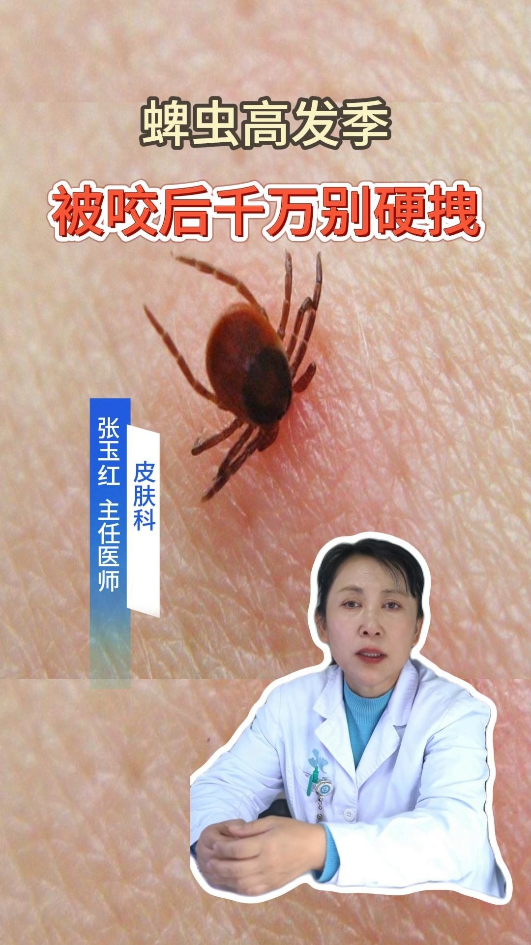 这可不是痣,这是蜱虫钻进皮肤里了!