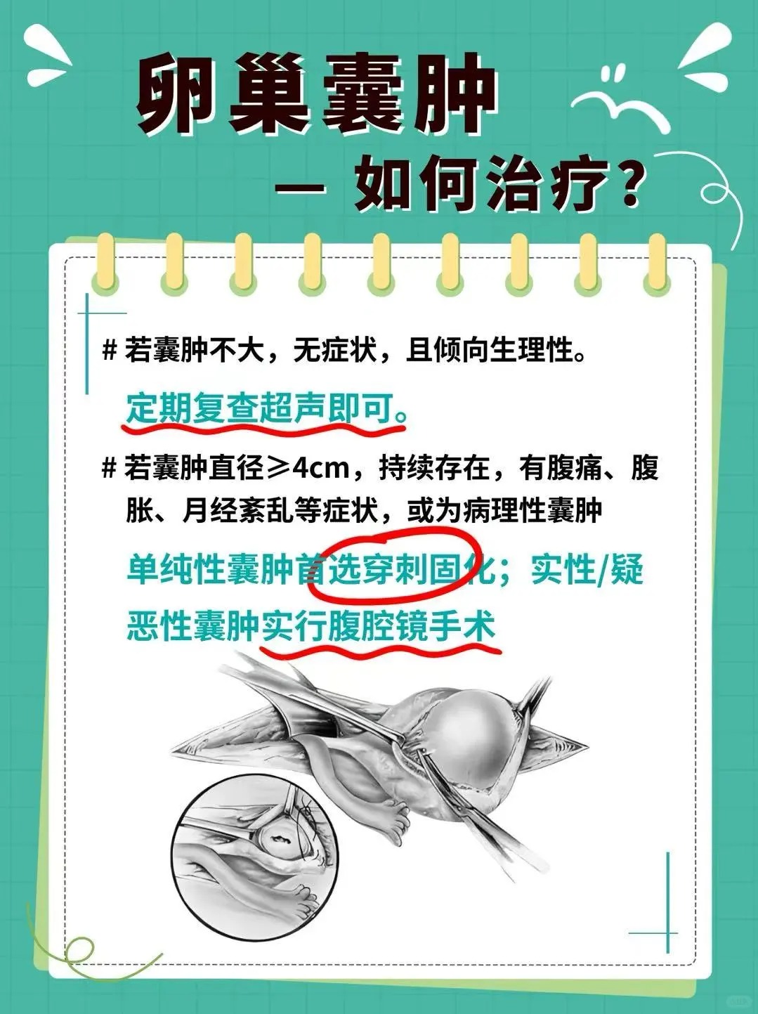 卵巢囊肿是女性盆腔内常见的良性病变,可发生在任何年龄段