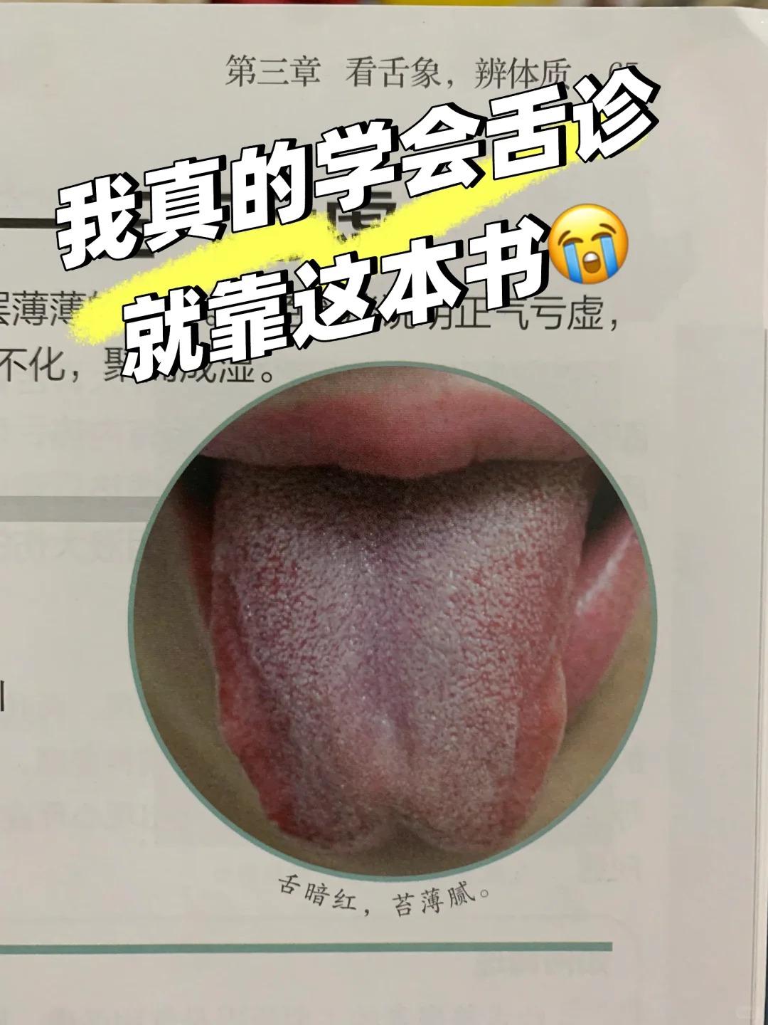 正常舌苔呈淡红色薄白而湿润若出现异常需警惕