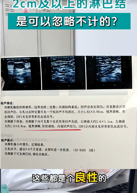 良性淋巴结一般不超过多大