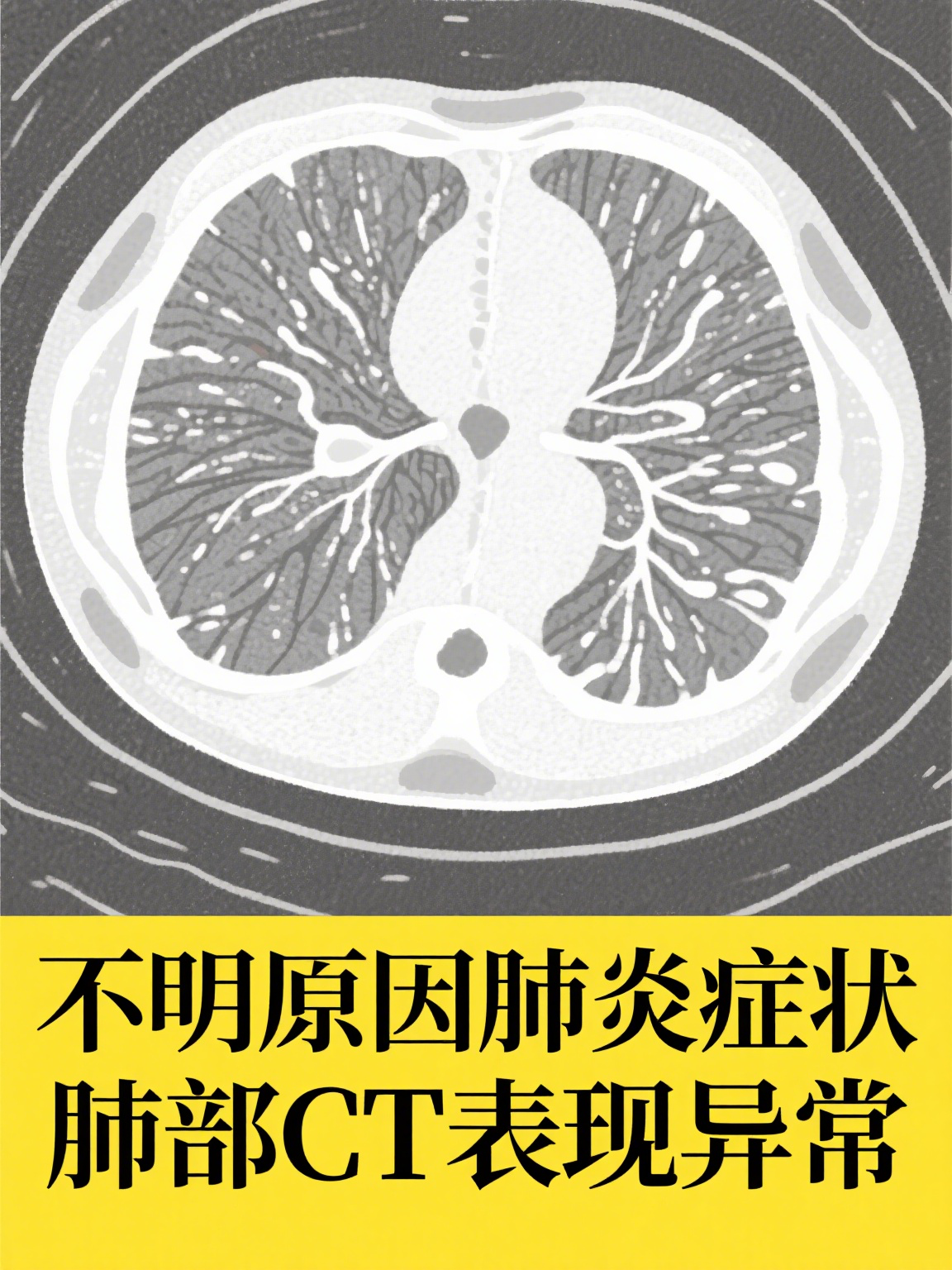  武汉新冠什么时候爆发的(武汉市新冠肺炎是从什么时候开始爆发的)