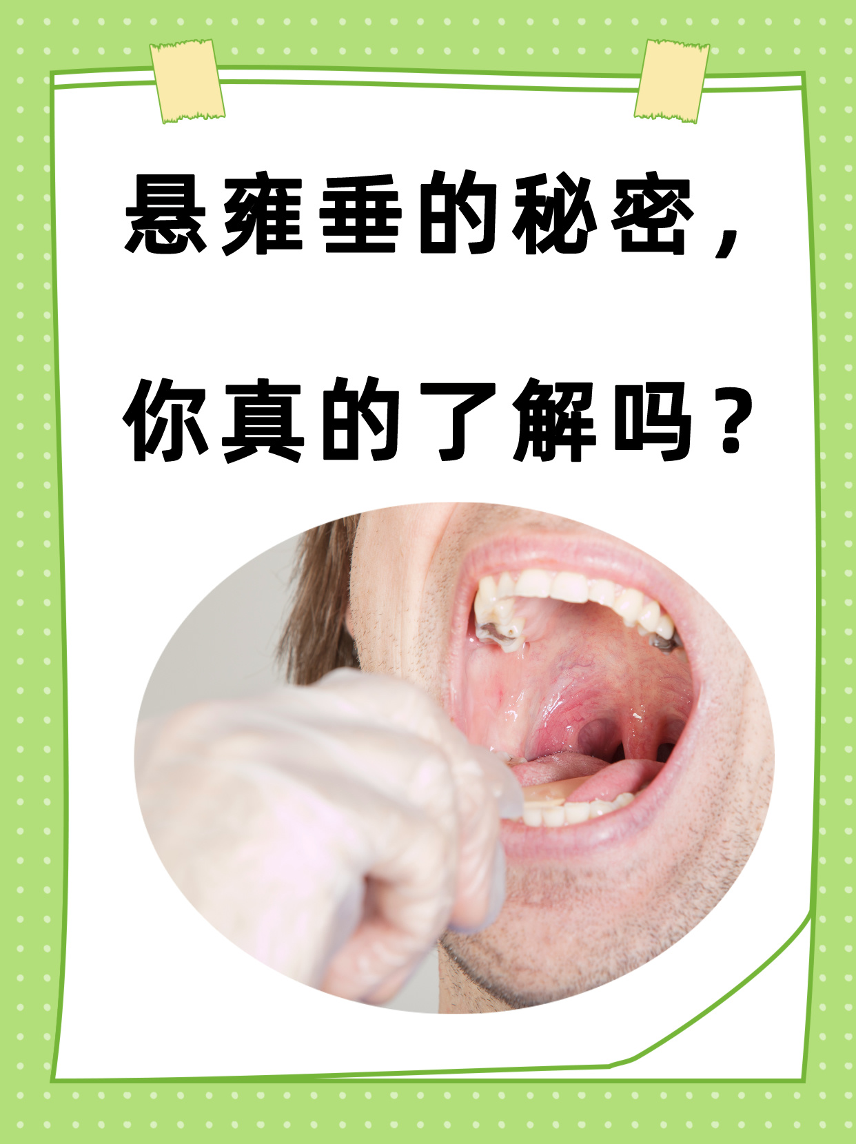 大家好,今天我要来聊聊一个我们口腔里的小秘密