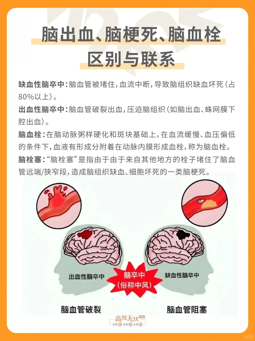 解读脑外科：技术不断进步的神经守护者