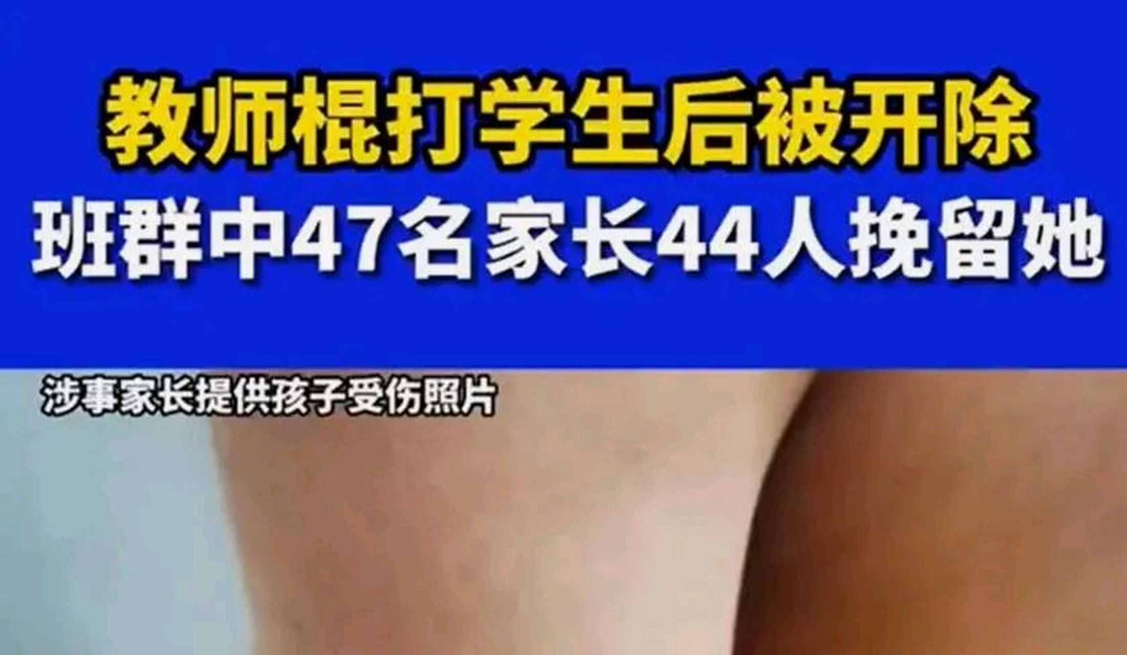 教師體罰學生開除44名家長挽留# 學生犯錯老師到底能不能體罰?