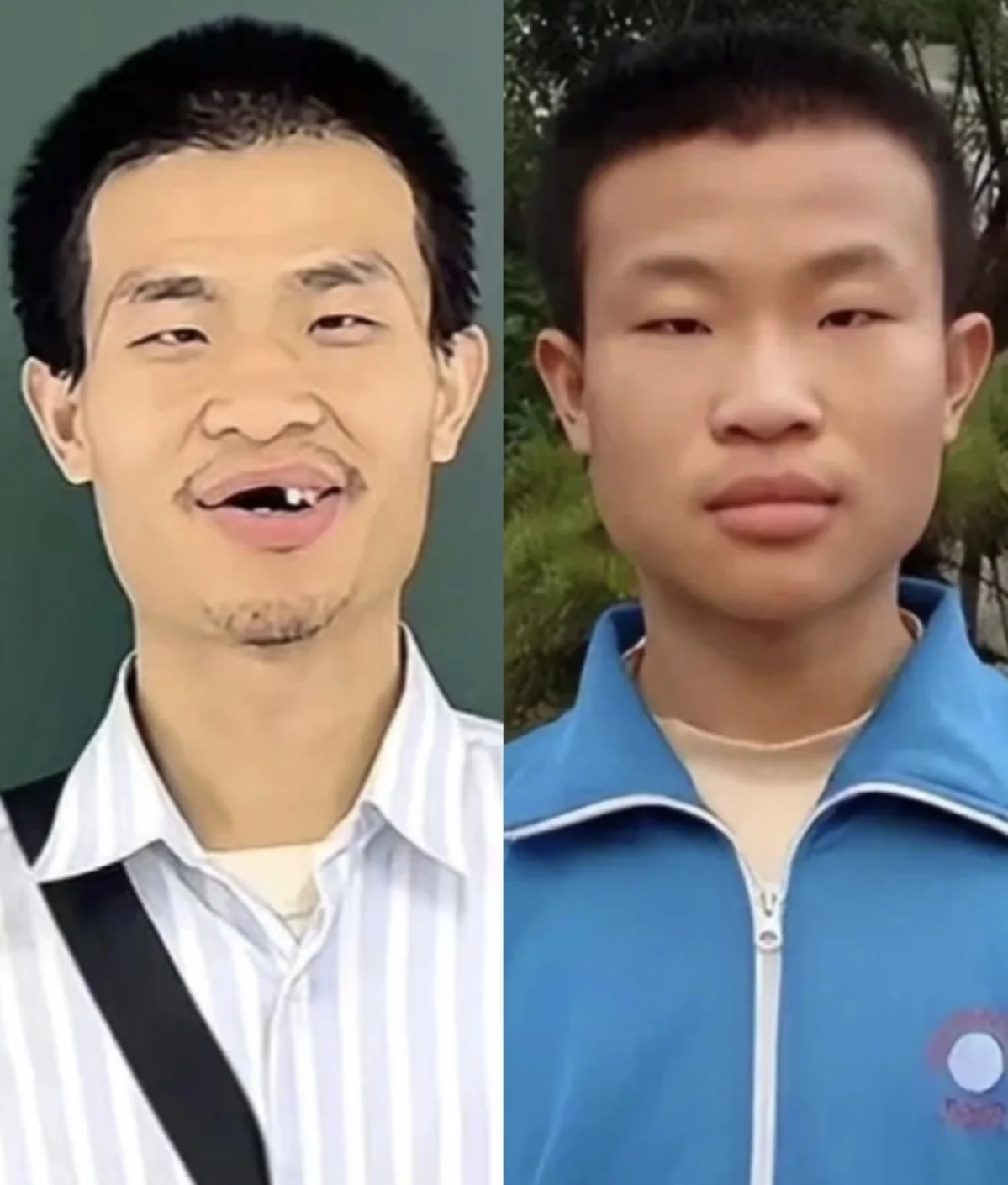之前也有人说过韦神可能有比较严重的谱系障碍比如食物单一说话眼睛