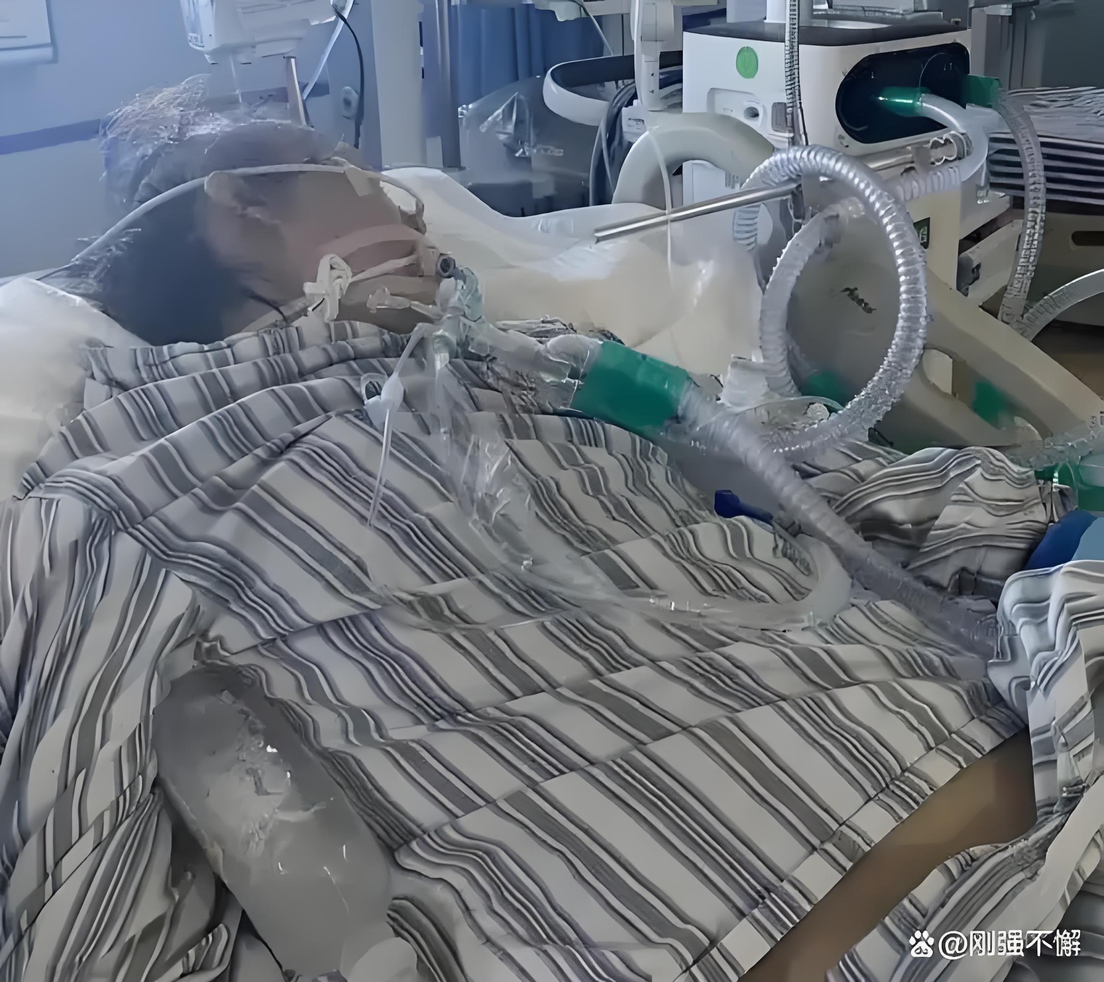 邻居婆婆今年 87 岁了,在医院重症监护室二十多天了,一天花费 2 万多