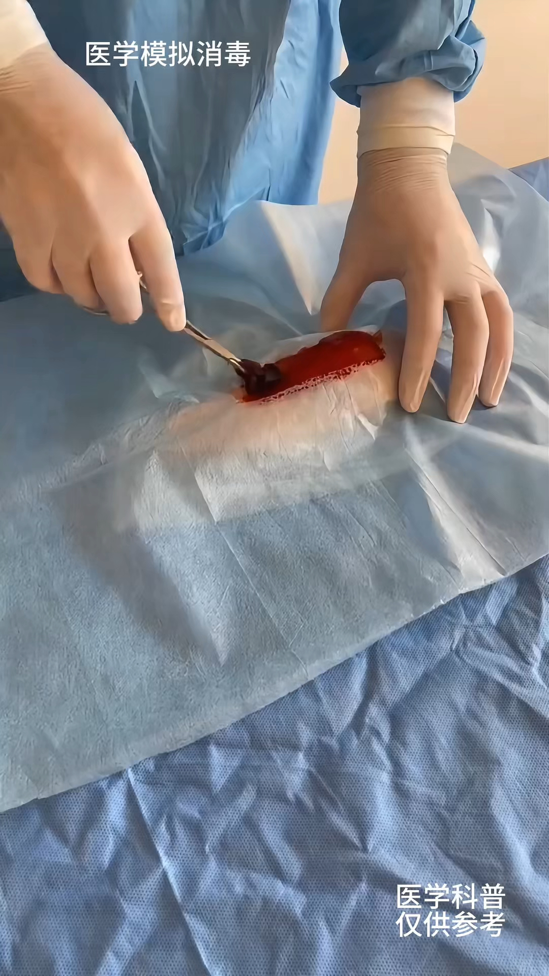 医学生模拟手术中消毒缝合演示