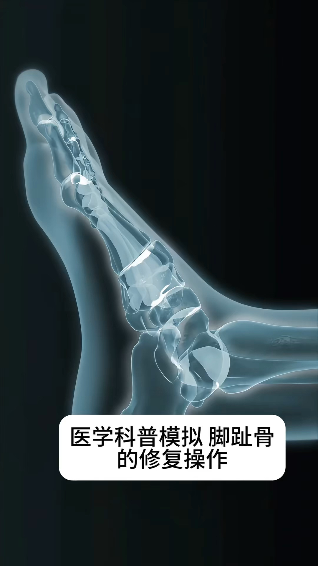 骨骼动画=骨骼动画教程