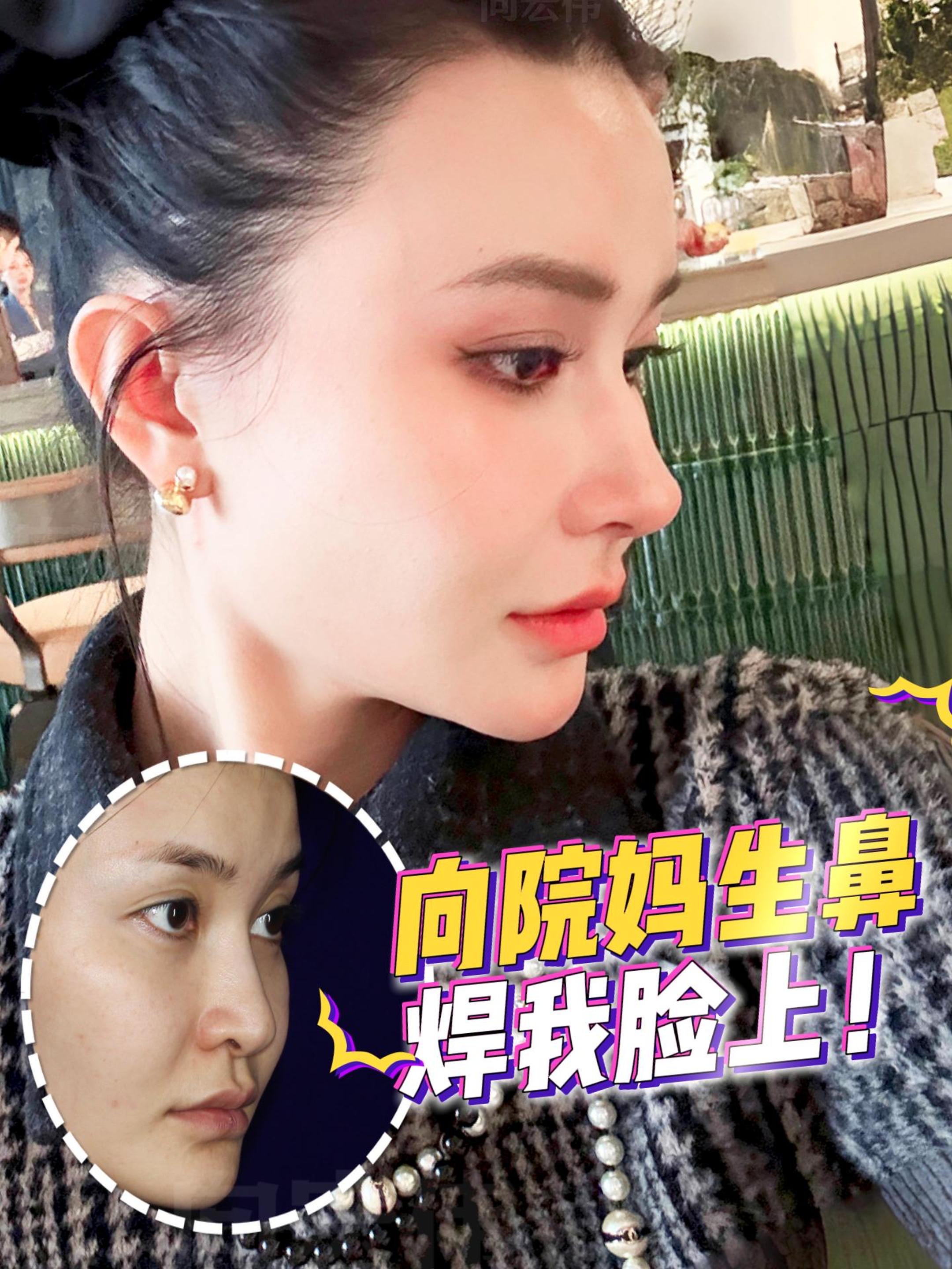 妈生鼻来啦
