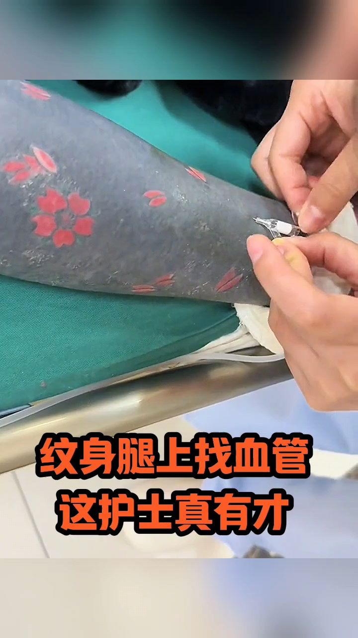 纹身腿上找血管,这护士真有才!