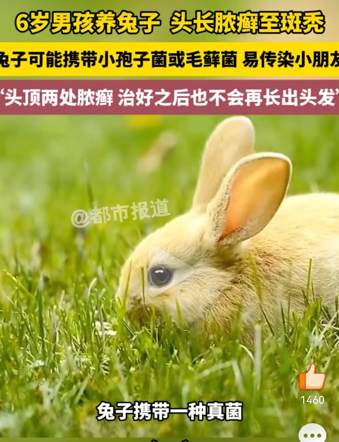 郑州一6岁男孩养兔子结果头上长了脓癣还斑秃了