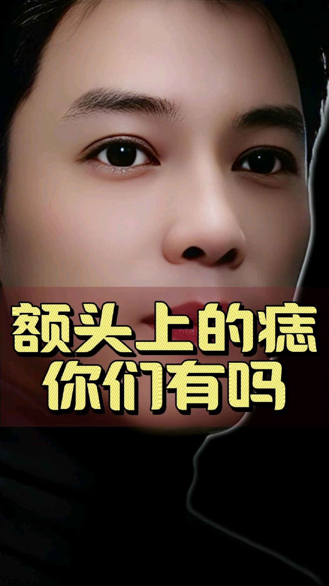 额头上的痣,你们大家有吗?