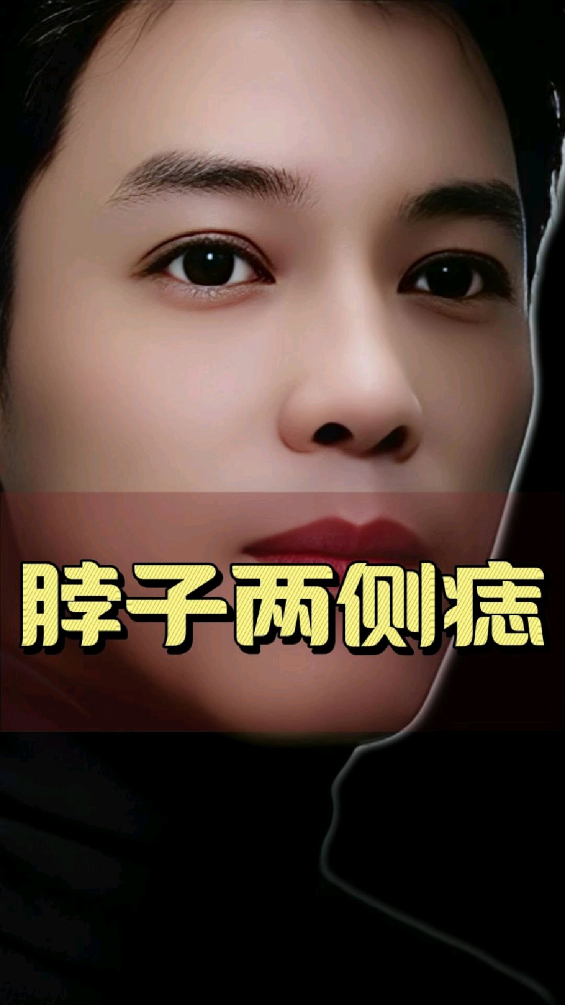 脖子两侧有痣,能不能留呢