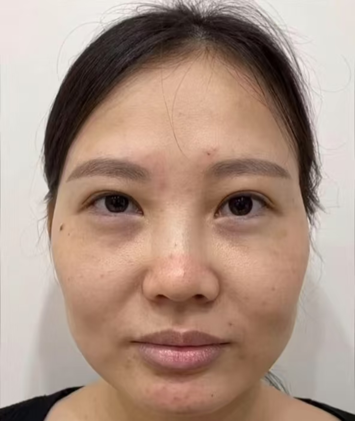 关于北医三院、号贩子电话,省时省力省心权威手术专家的信息 关于北医三院、号贩子电话,省时省力省心权威手术专家的信息