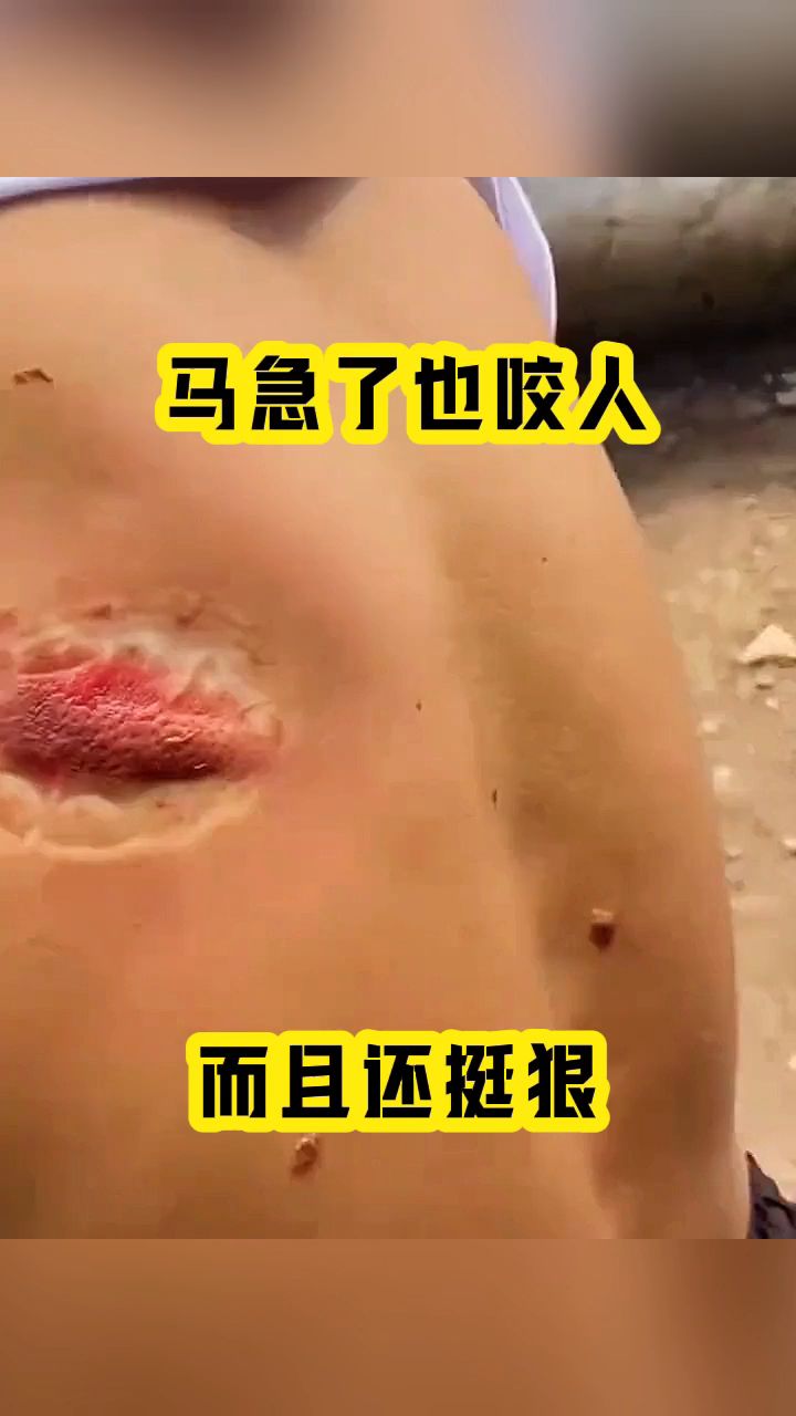 马急了也咬人,而且还挺狠