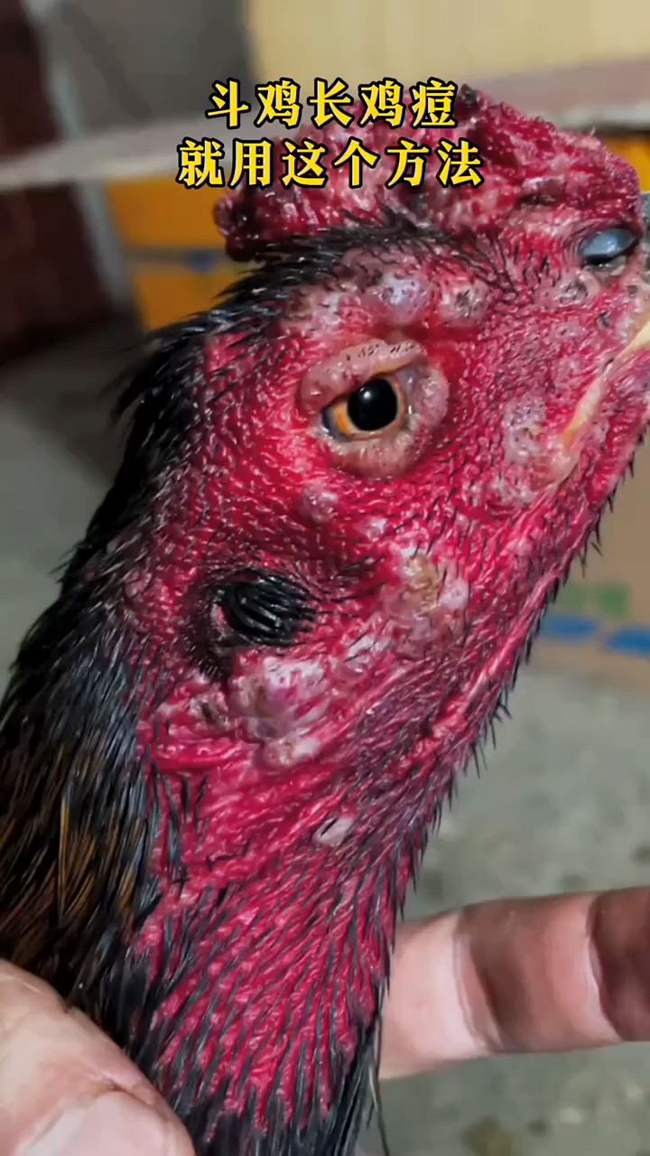 鸡痘太多怎么办啊