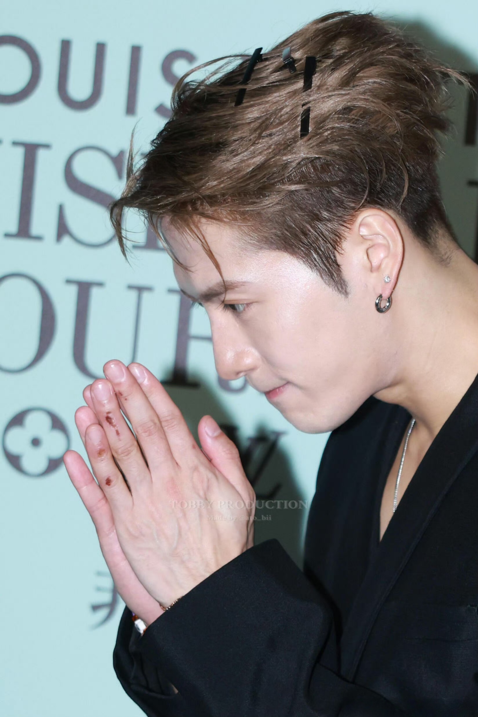 哎呀妈呀,这都多少天,王嘉尔手上的伤还没好 看起来真的挺疼的,希望