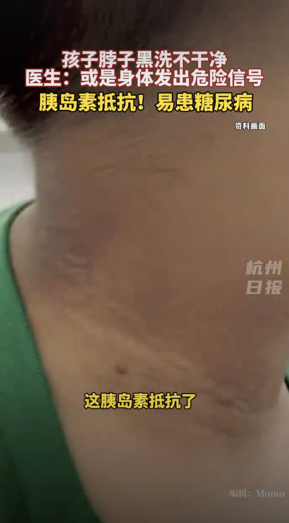 脖子洗不干净或是身体的危险信号?