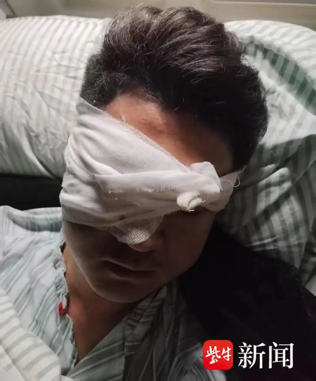 安徽一30多岁男子在除夕夜右眼被炸伤致眼球摘除,这事儿可太揪心啦!