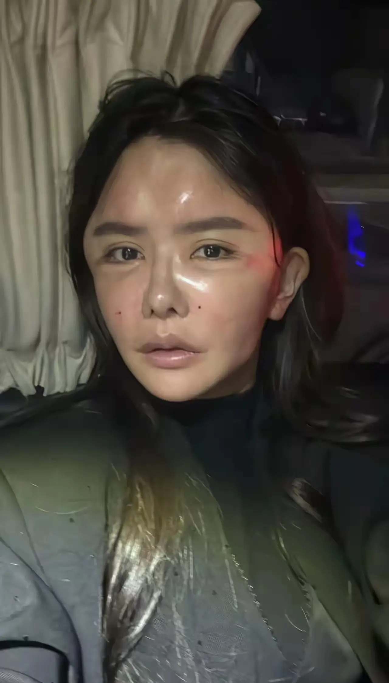 尤其是太阳穴打的那么突出, 卧蚕整得那么明显