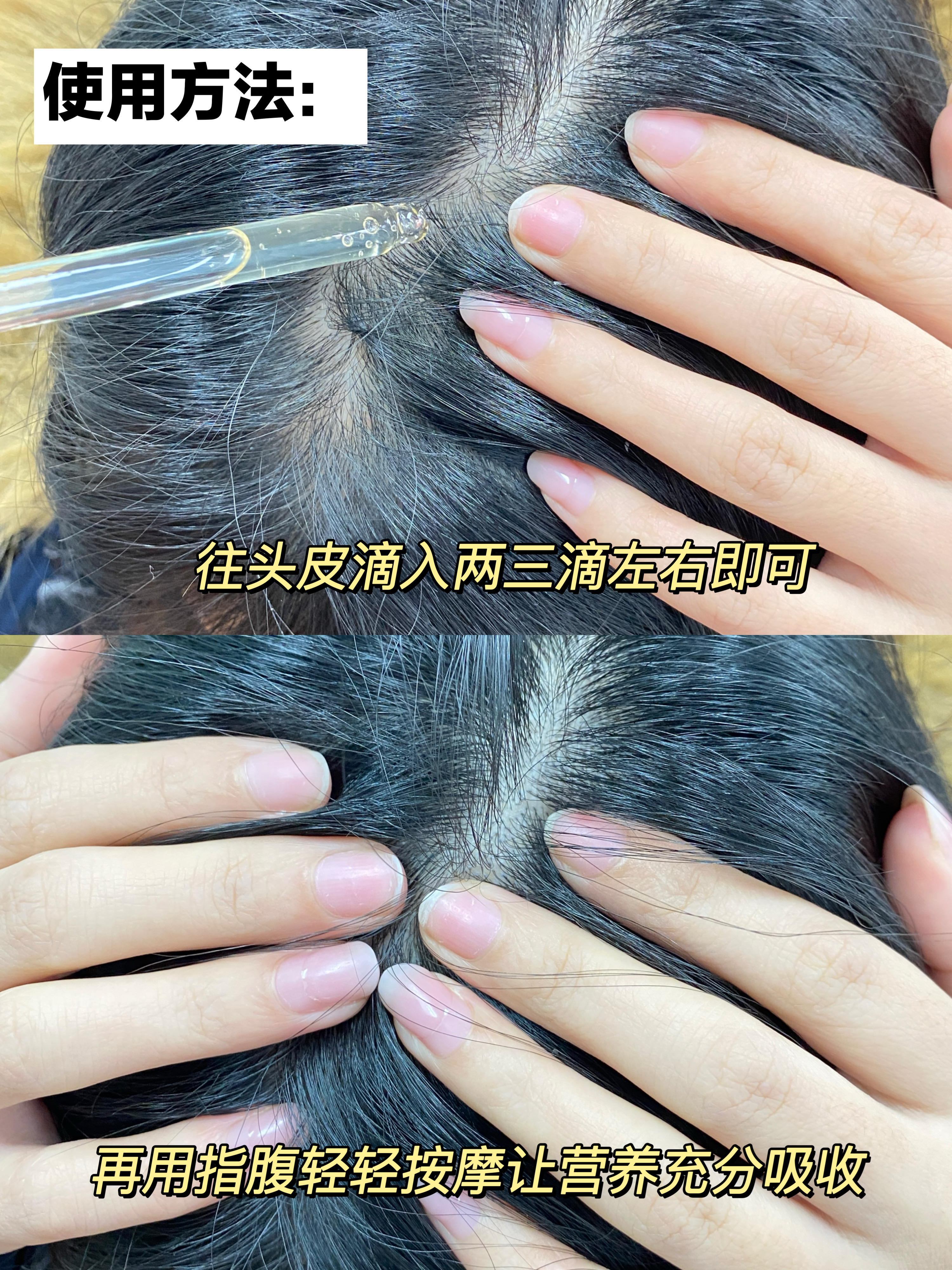 露卡菲娅防脱精华液 排名第一的防脱生发产品 防脱产品排行榜前