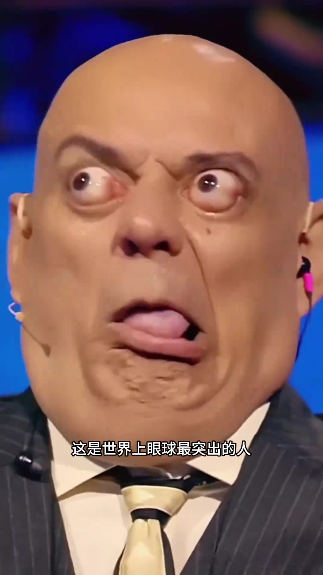 世界上眼球最突出的人