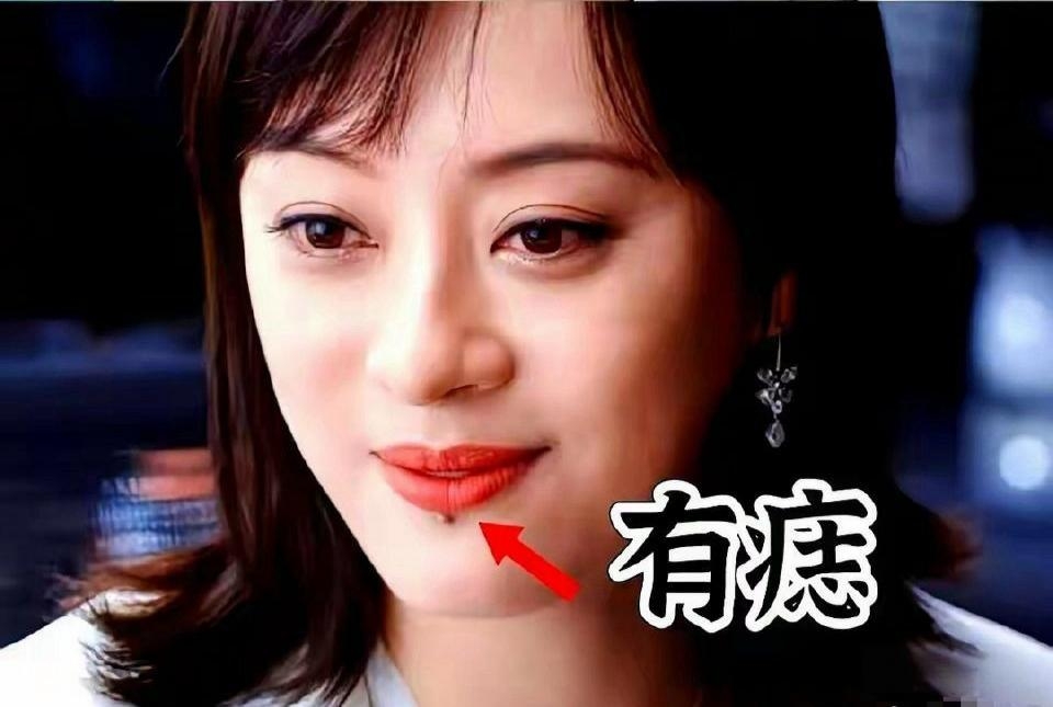 你们发现没,孙俪下巴自从有了这个"痣"以后,她拍的剧就不好看了