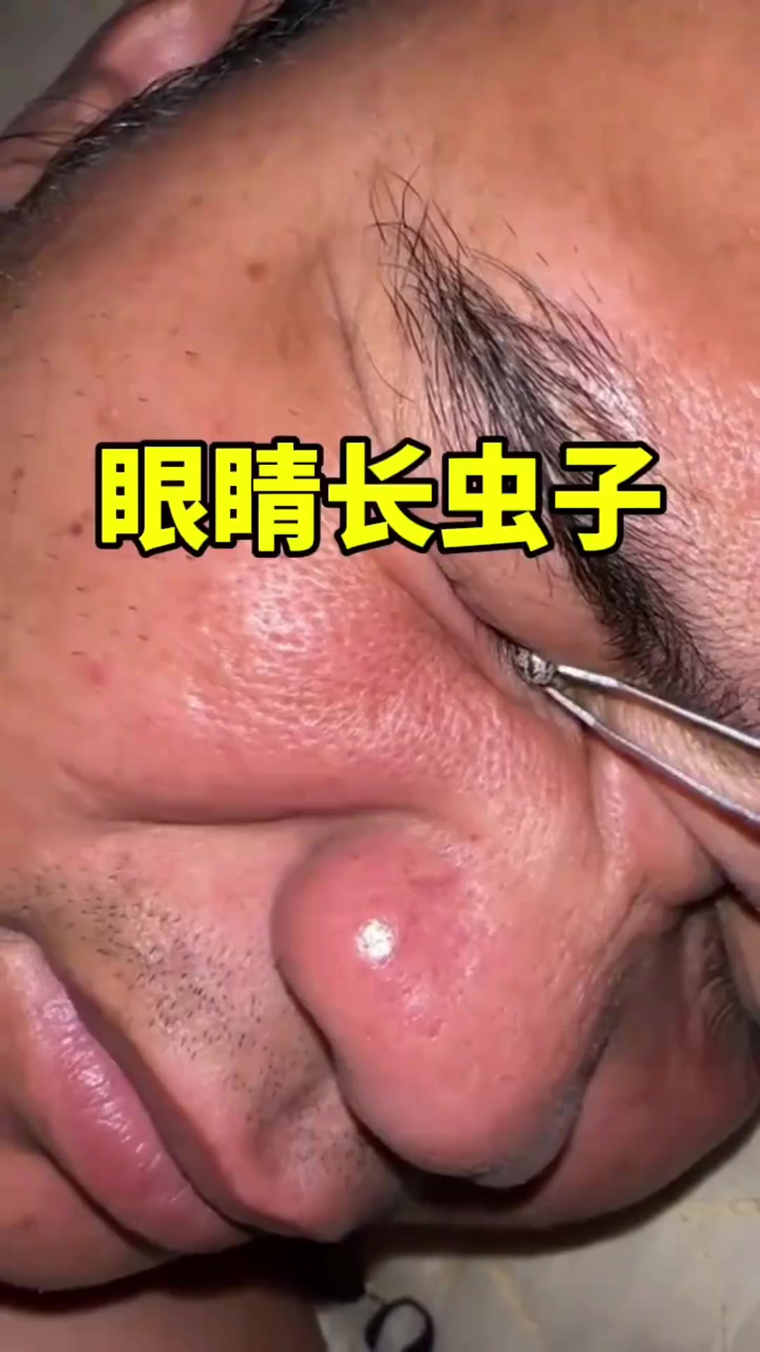 "眼睛里的虫子:深夜惊魂与未解之谜的惊悚交织"