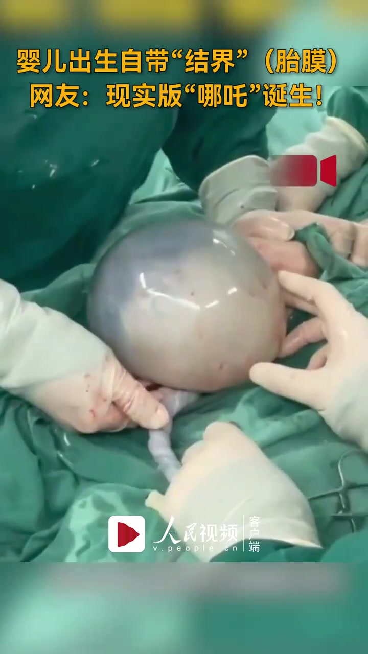婴儿出生自带"结界"(胎膜),网友:现实版"哪吒"诞生!