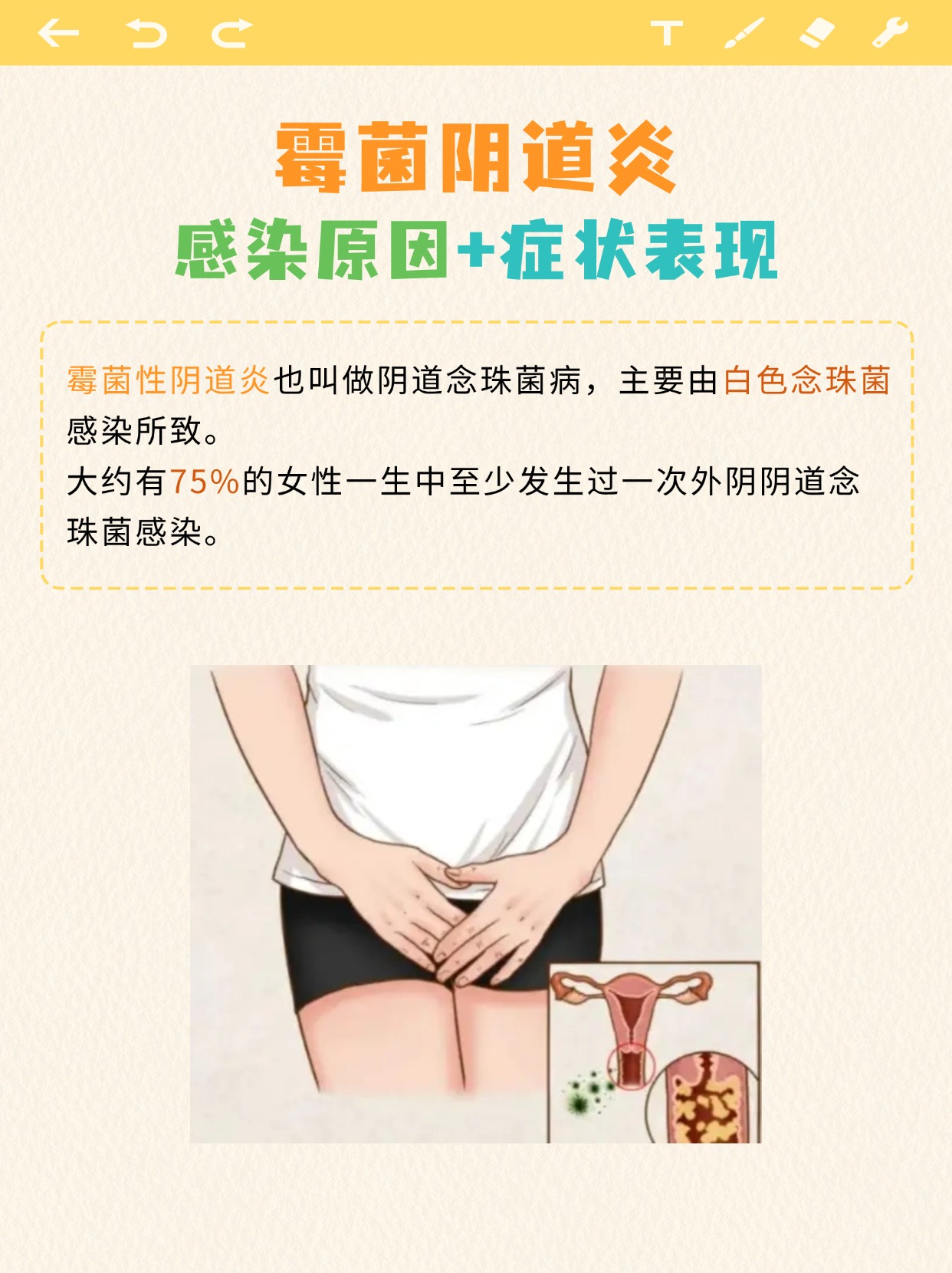 霉菌阴道炎感染原因 症状表现 霉菌性阴道炎也叫做阴道念珠菌病,主要