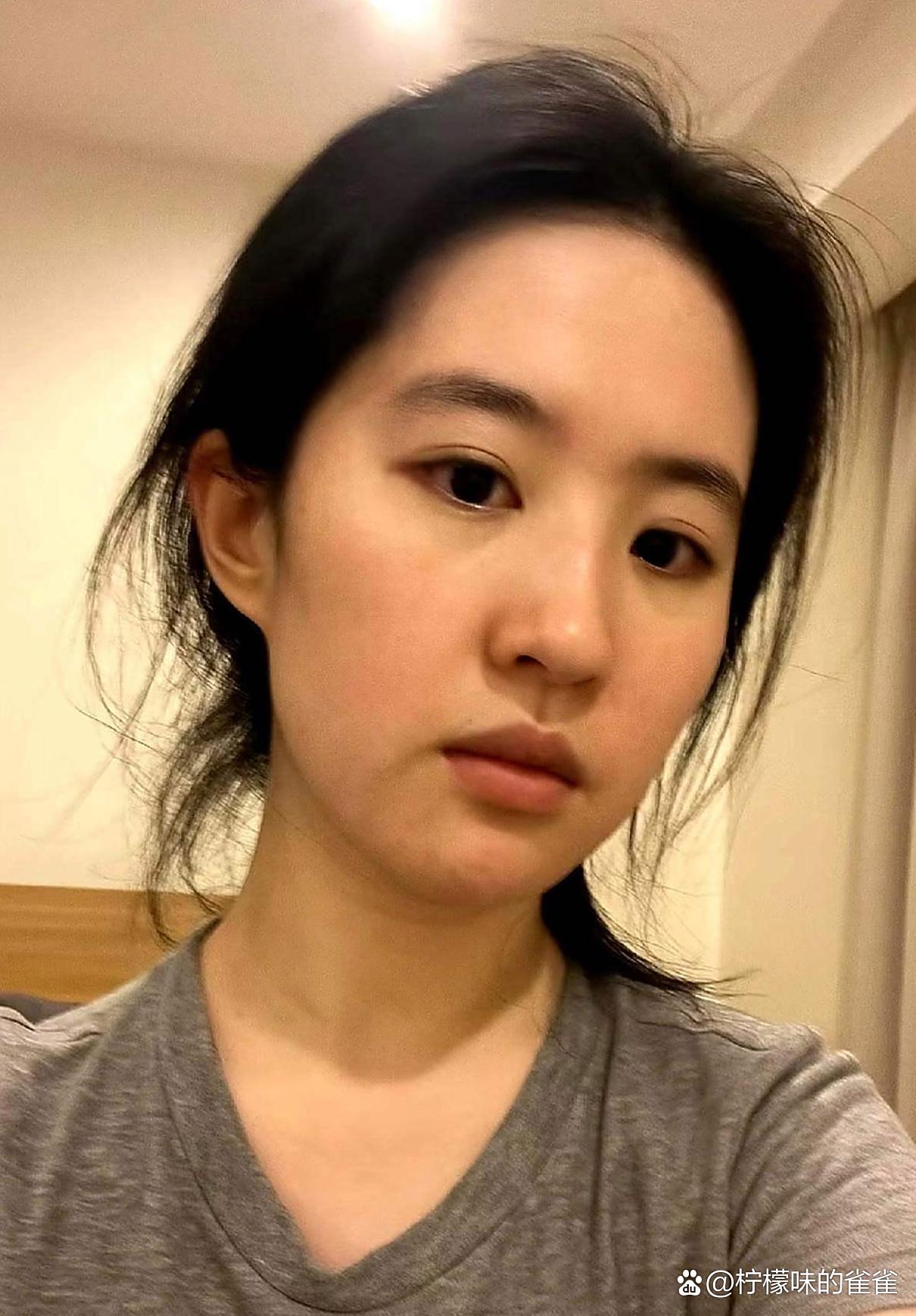 皮肤看着暗淡无光颧骨凸得特明显俩眼睛跟要分家似的状态不太行跟