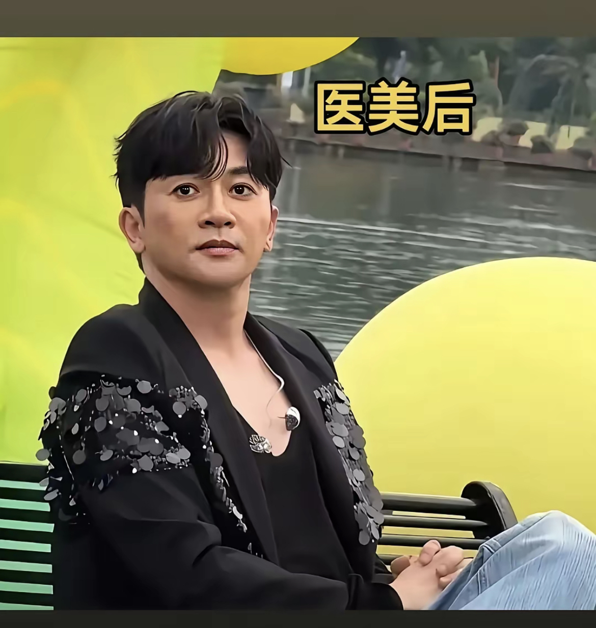 其实单纯去看 也就是开了个眼角