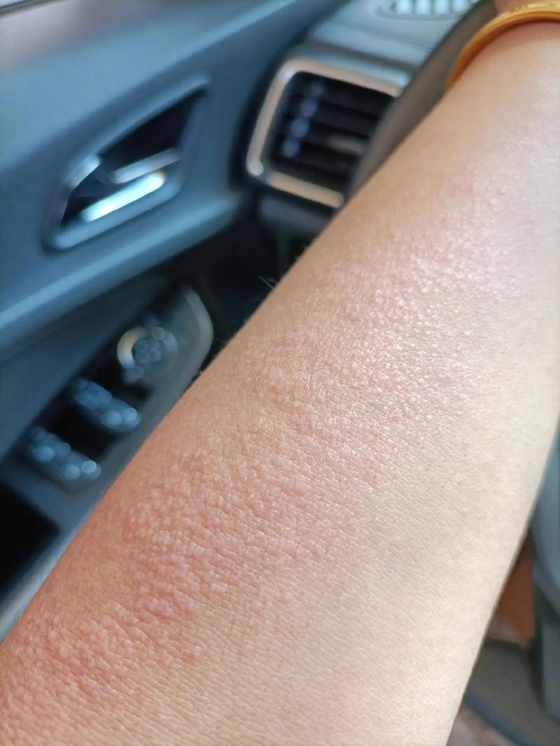 春天的阳光温暖,但紫外线也很强!