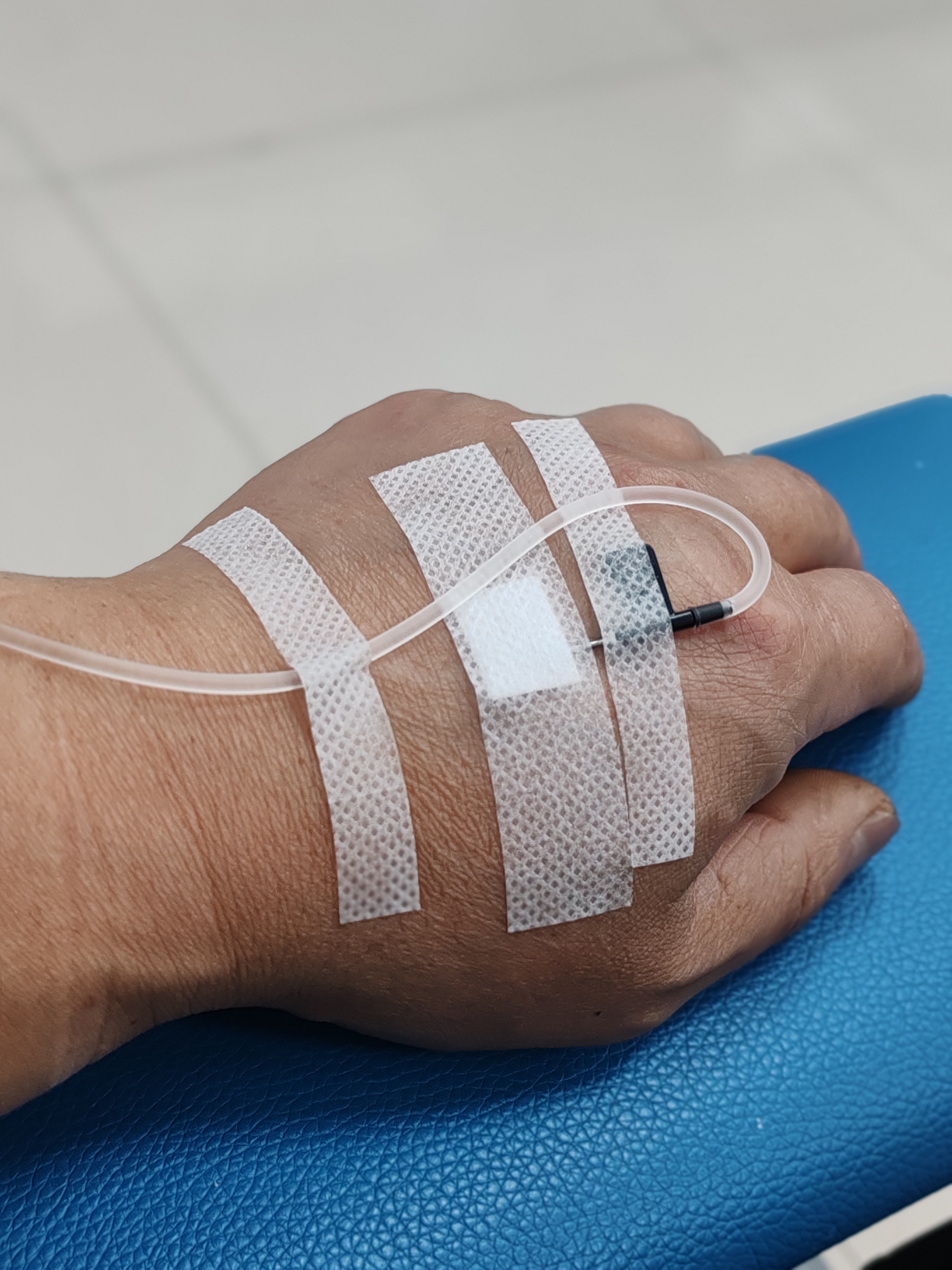 来医院打点滴了 这个是第三针了,屁股一边一针 已经