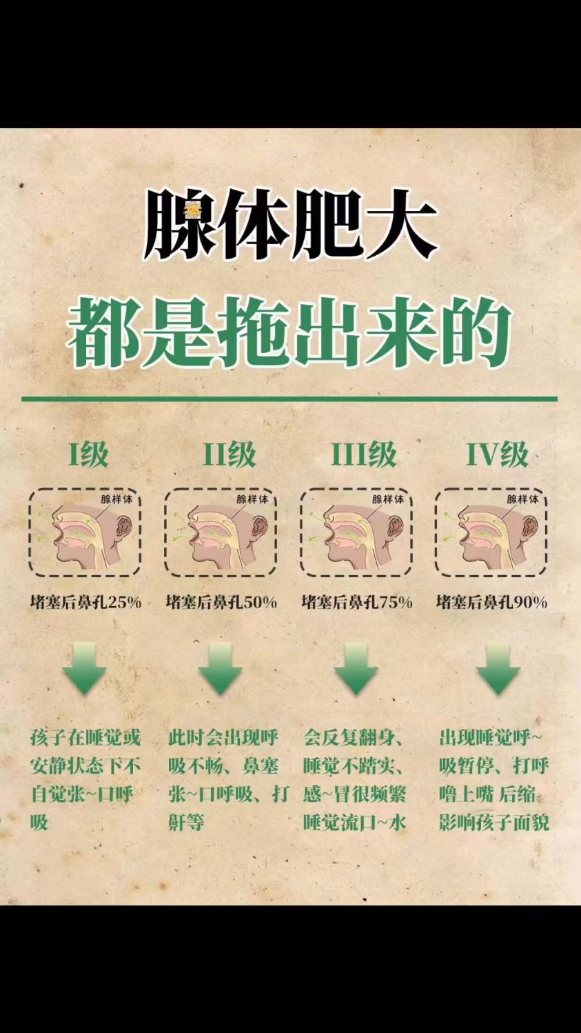 腺样体肥大你必须要知道的知识!