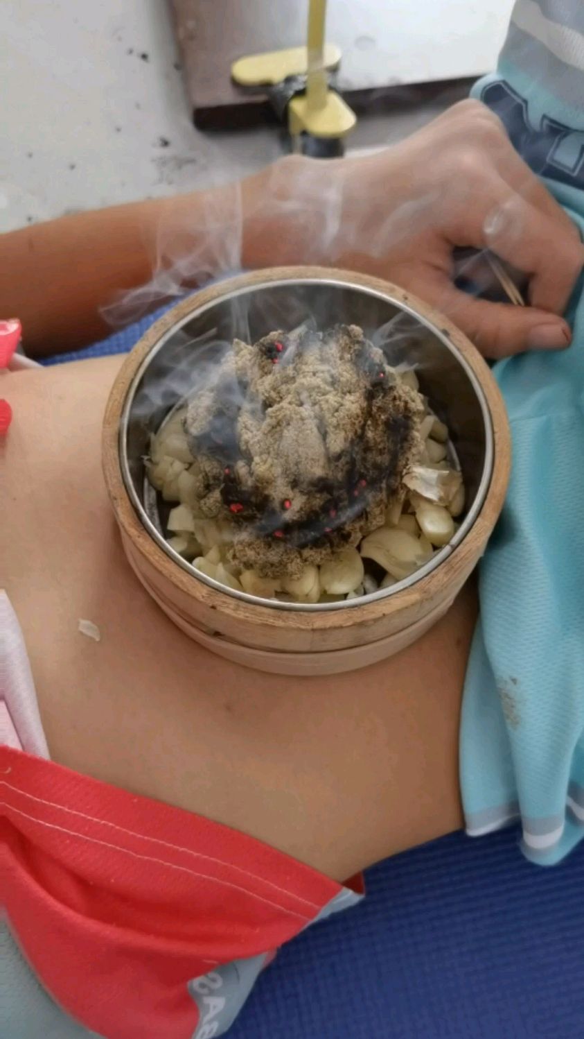 小朋友贪凉偷吃冰淇淋,咳嗽白痰,给隔蒜灸灸