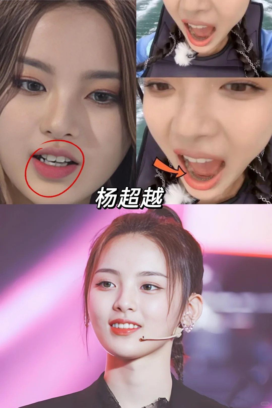 原来整牙的明星那么多,笑容迷人都有共性 不仔细看,很难