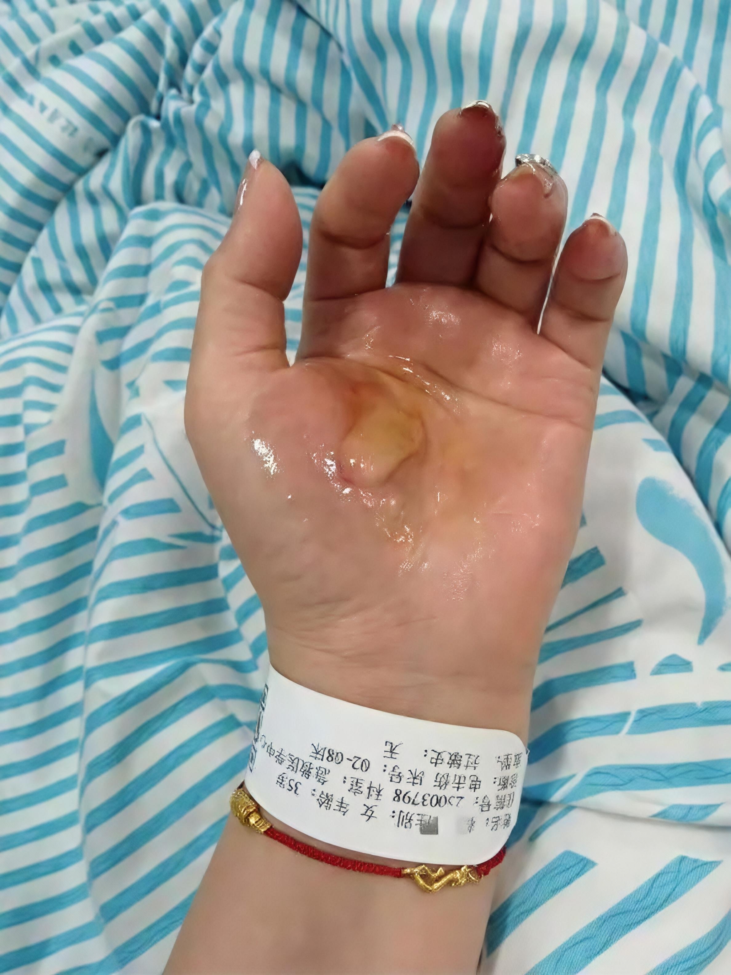 海南乐东县有个35岁的女子,在家洗澡的时候,居然因为