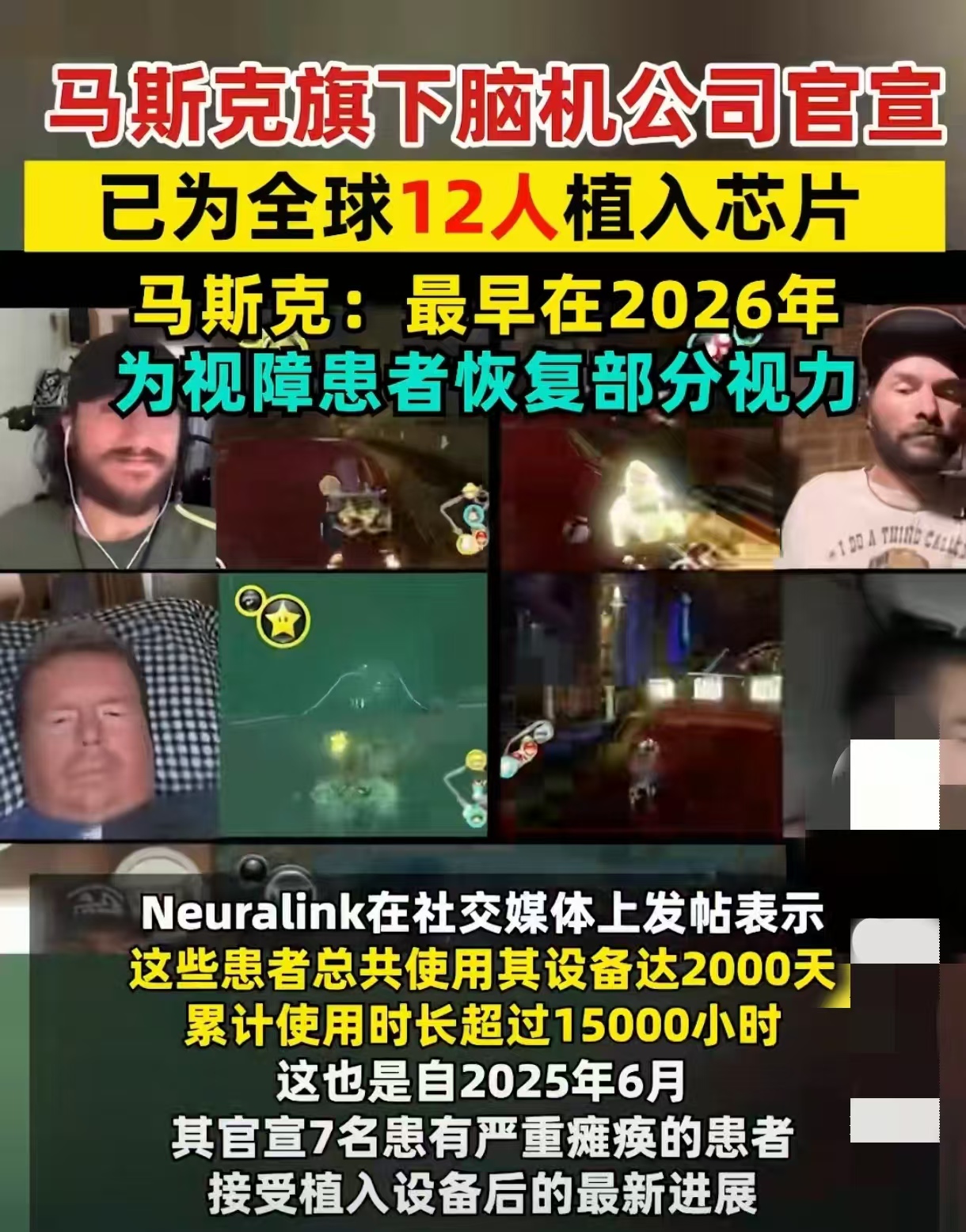 马斯克最早在2026年为视障患者恢复部分视力