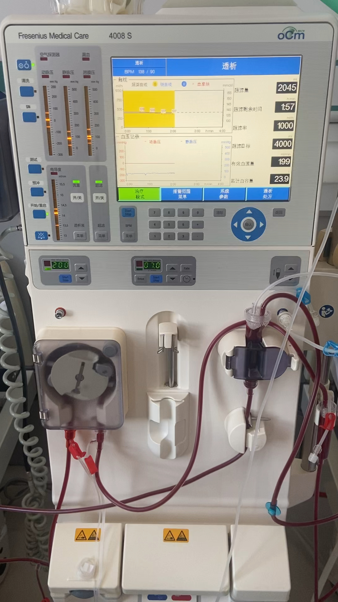 解锁雪净灌流器"很多人听血液透析,但血液灌流是什么?